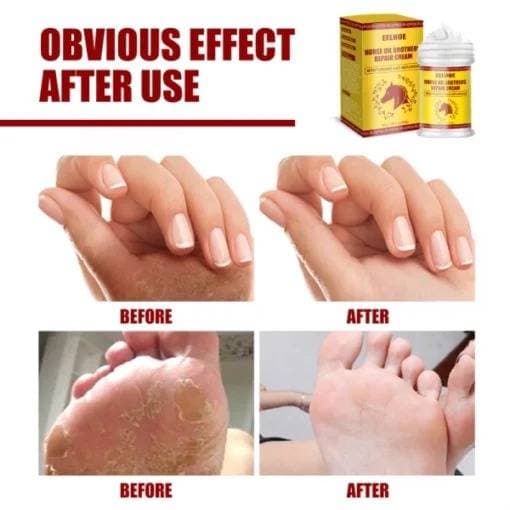 Hand & Foot oil repair care Dry cracked feet skin winter prevent peeling whitening cream thumbnail 4