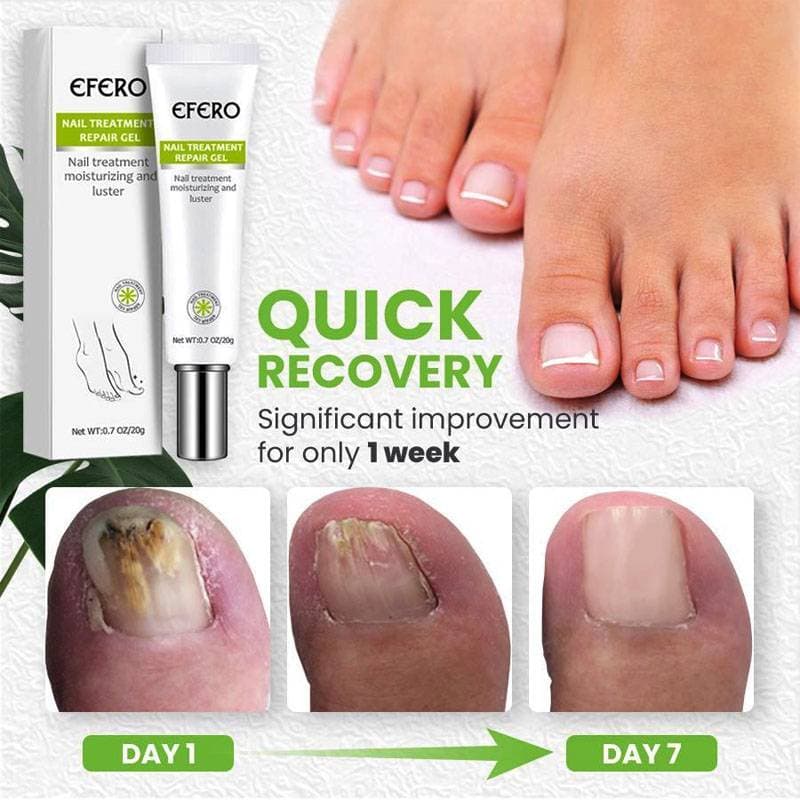 Anti Fungal Removal Nail Treatment Serum thumbnail 2