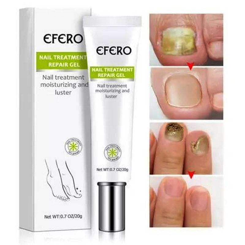 Anti Fungal Removal Nail Treatment Serum thumbnail 4